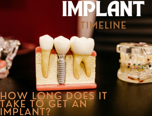 How Long Does it Take to Get an Implant?