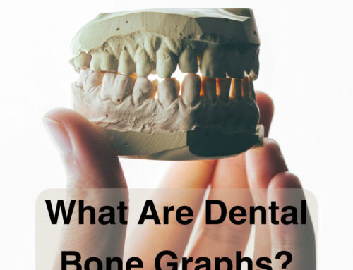 What are Dental Bone Graphs?