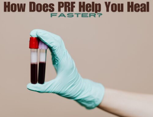What is PRF? How Does it Help with Oral Surgery?